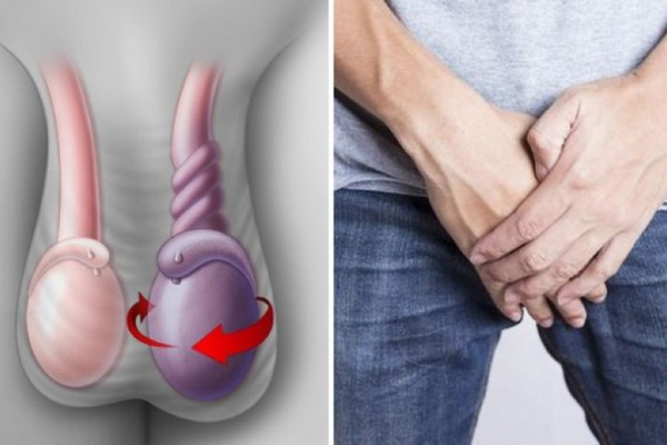 Các bệnh tinh hoàn thường gặp: nhận biết thay đổi và khám đúng lúc