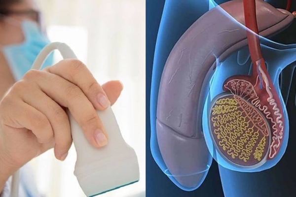 Siêu âm tinh hoàn giá bao nhiêu? Cách hỏi hạng mục và hiểu kết quả