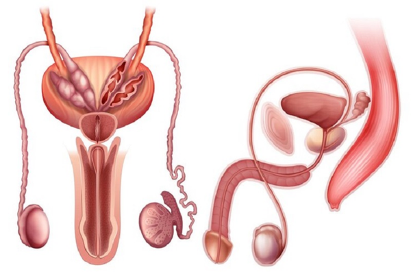 Phì đại lành tính tuyến tiền liệt: Khi nào cần điều trị?